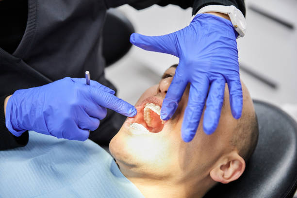 Best Dentist for Tooth Abscess  in Seneca Knolls, NY